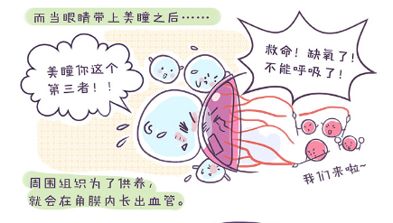 长期戴隐形眼镜 小心你的角膜会“呼吸衰竭”图三.png 长期戴隐形眼镜 小心你的角膜会“呼吸衰竭”图三.png
